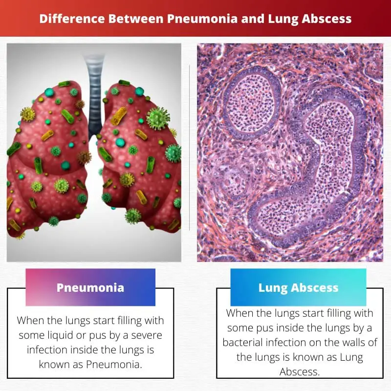 Difference Between Pneumonia and Lung Abscess