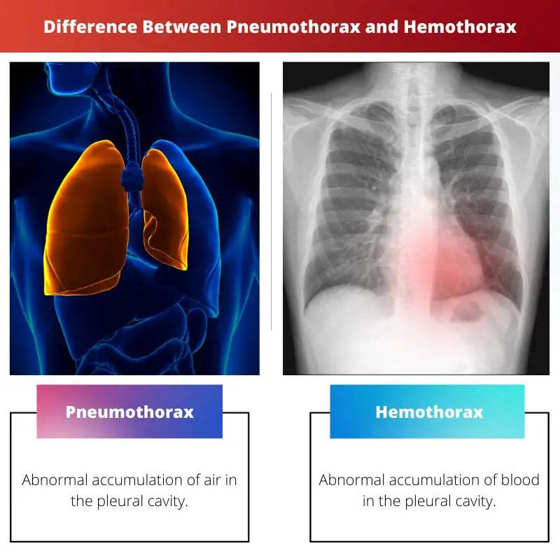 Difference Between Pneumothorax and