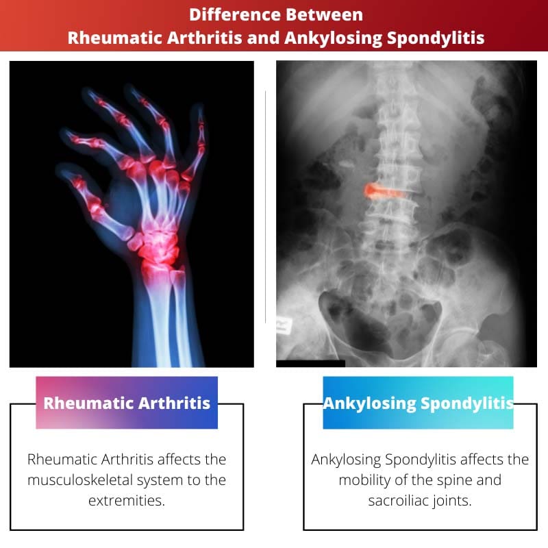 Difference Between Rheumatic Arthritis and Ankylosing Spondylitis