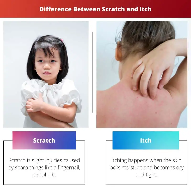Difference Between Scratch and Itch