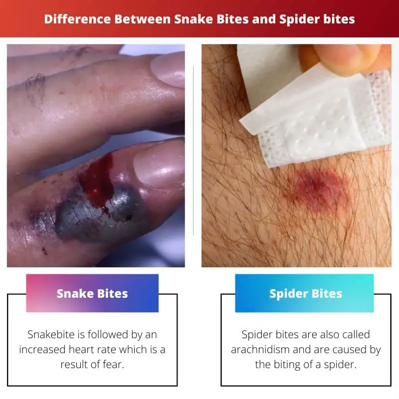 Difference Between Snake Bites and Spider bites