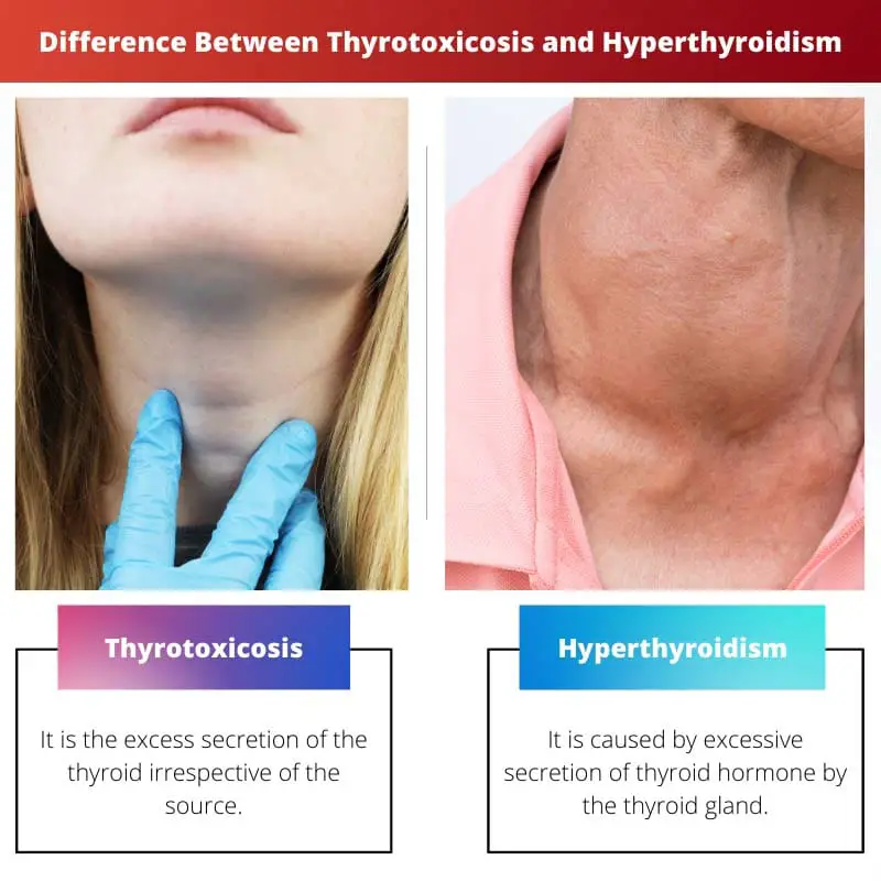 Difference Between Thyrotoxicosis and Hyperthyroidism