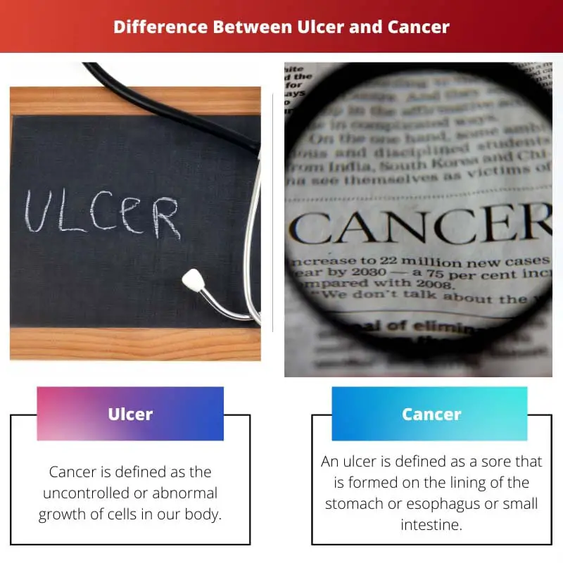 Difference Between Ulcer and Cancer