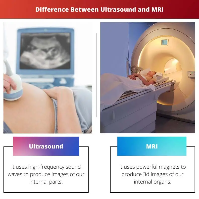 Difference Between Ultrasound and MRI
