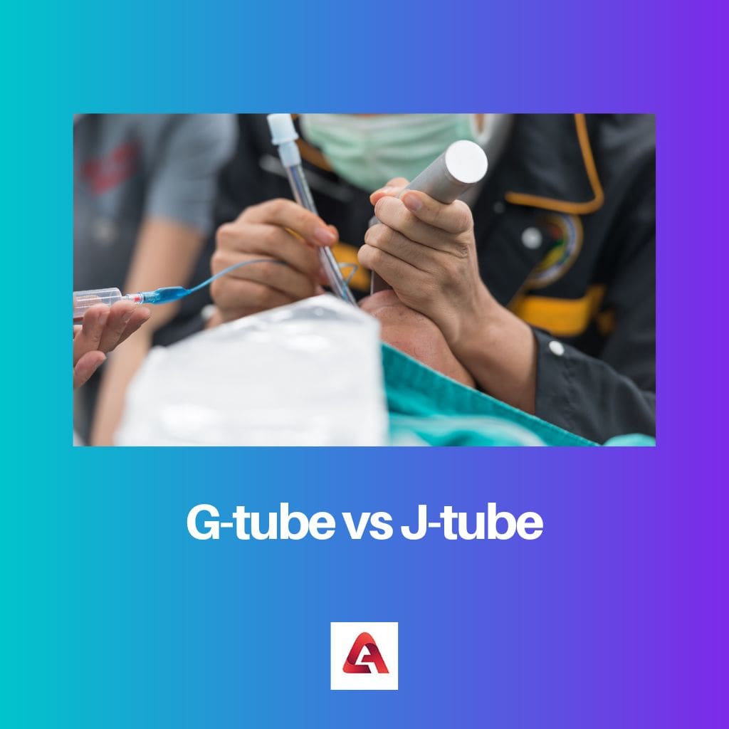 G tube vs J tube