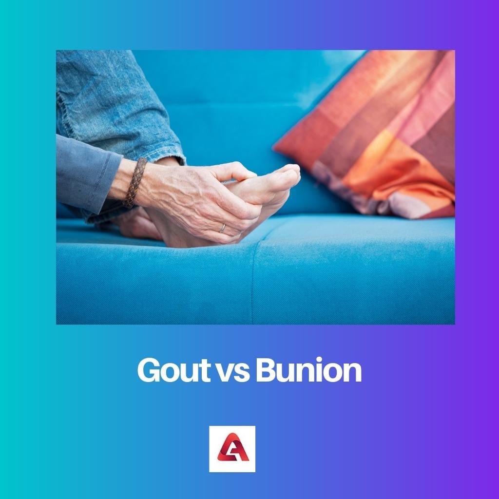 Gout vs Bunion