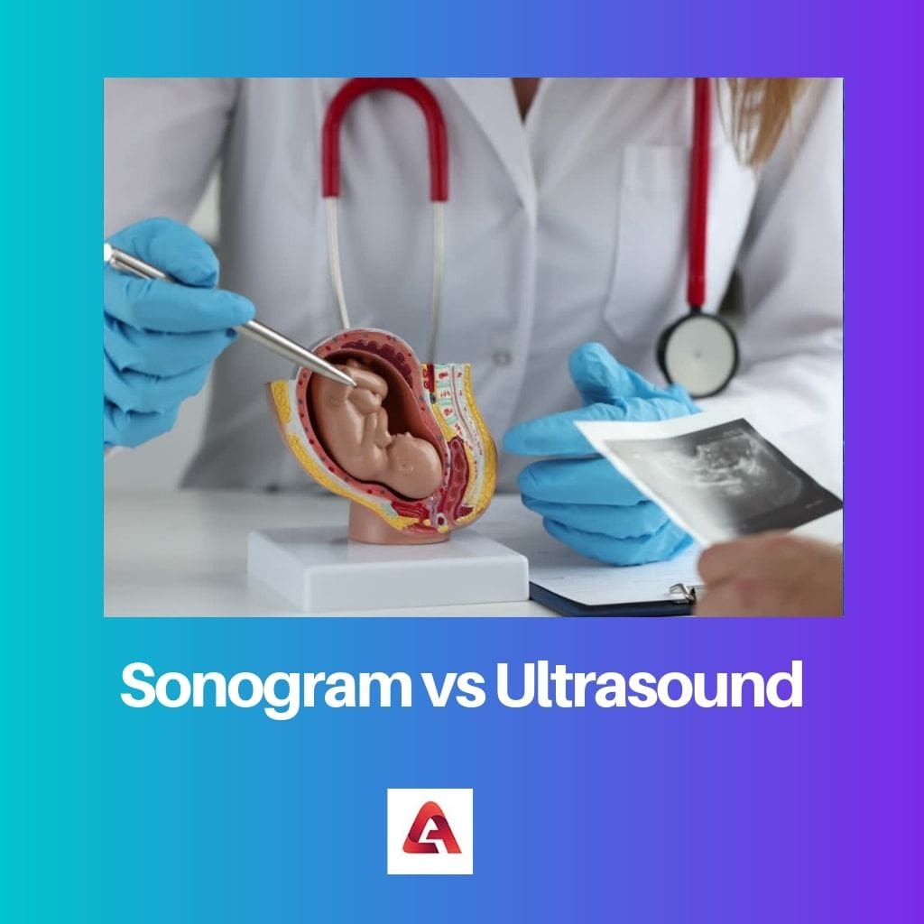Sonogram vs Ultrasound