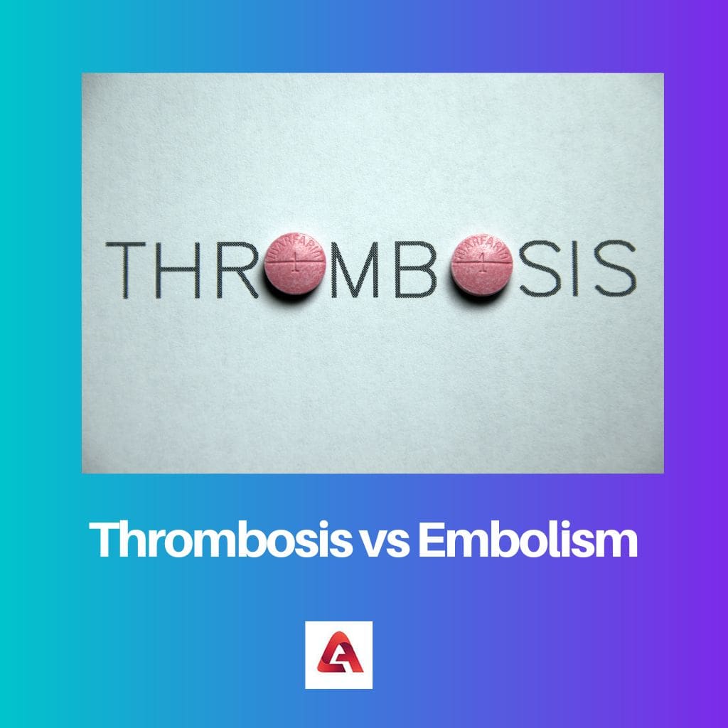 Thrombosis vs Embolism