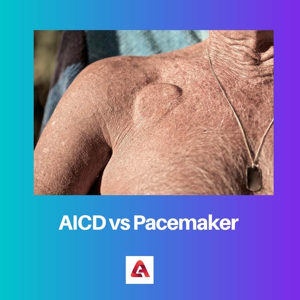 AICD vs Pacemaker
