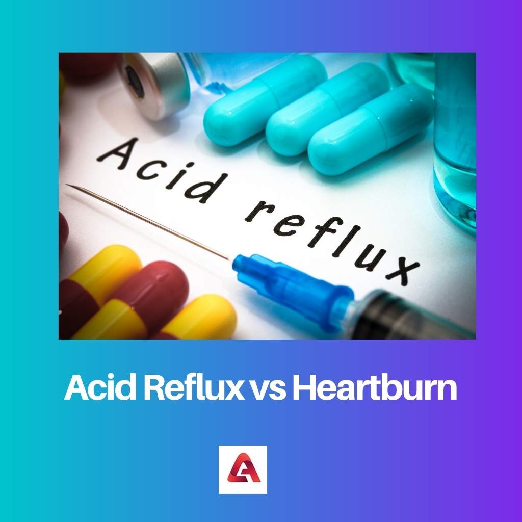 Acid Reflux vs Heartburn