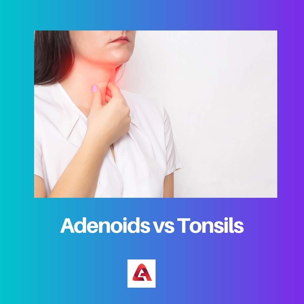 Adenoids vs Tonsils