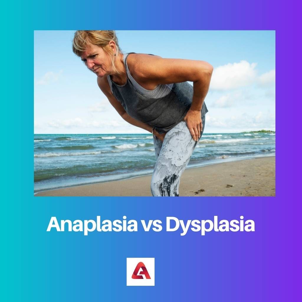 Anaplasia vs Dysplasia