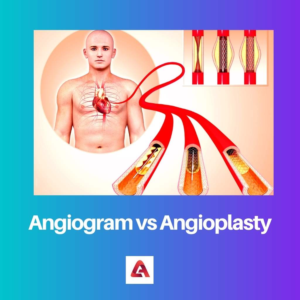 Angiogram vs Angioplasty
