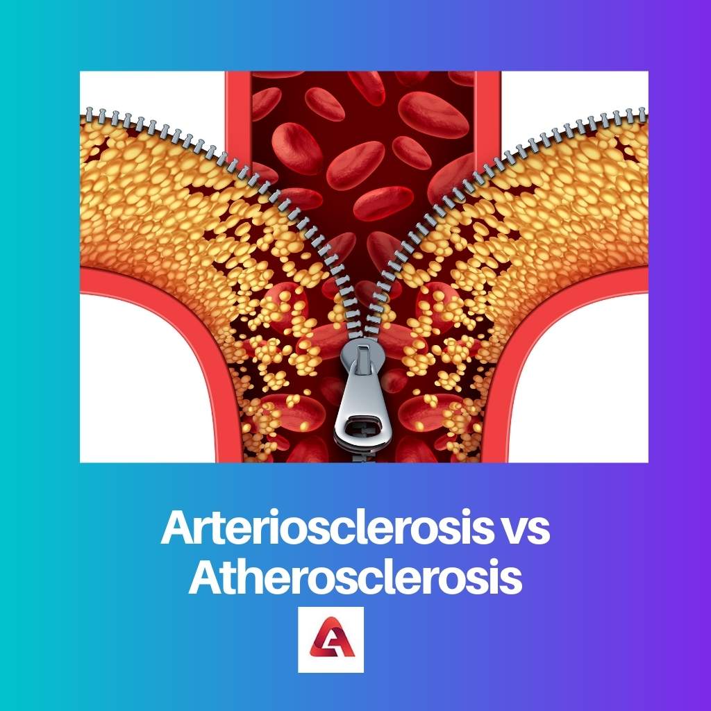 Arteriosclerosis vs Atherosclerosis