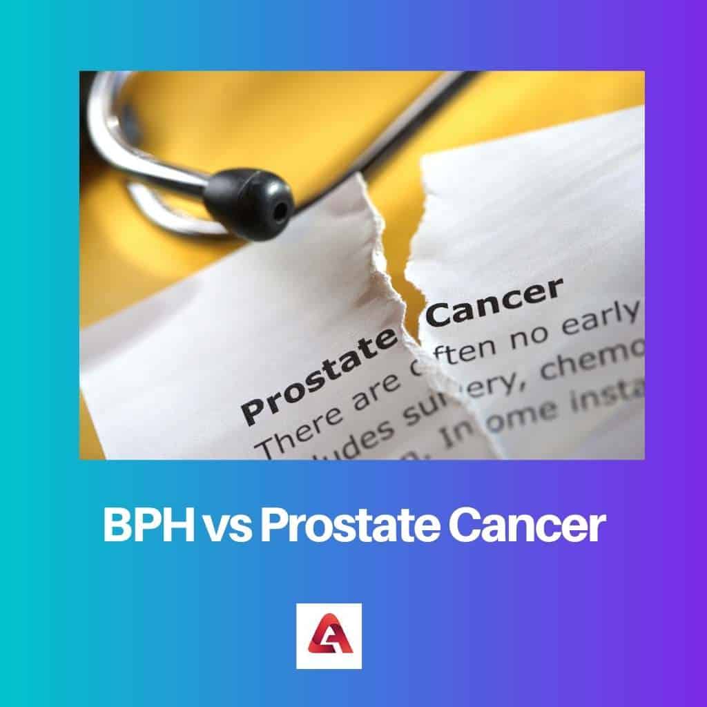 BPH Vs Prostate Cancer: Difference And Comparison