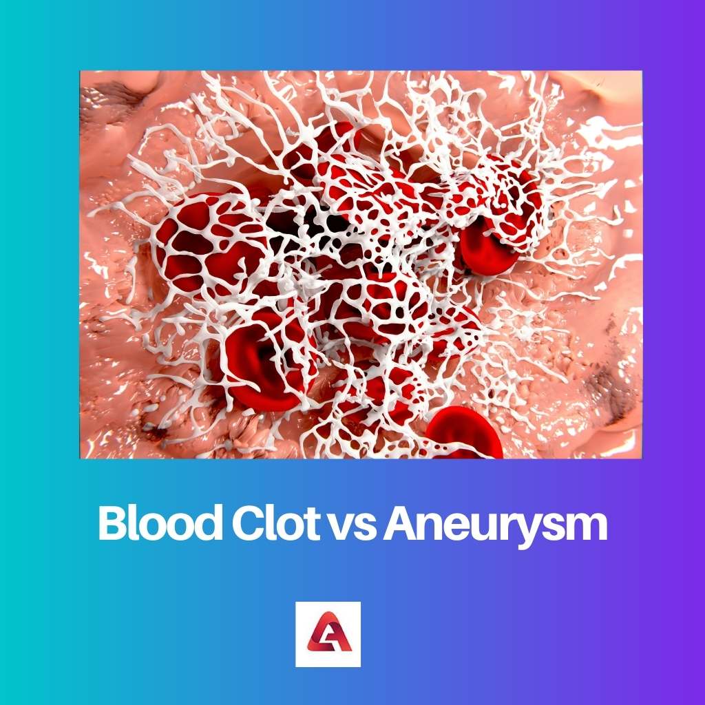 Blood Clot vs Aneurysm