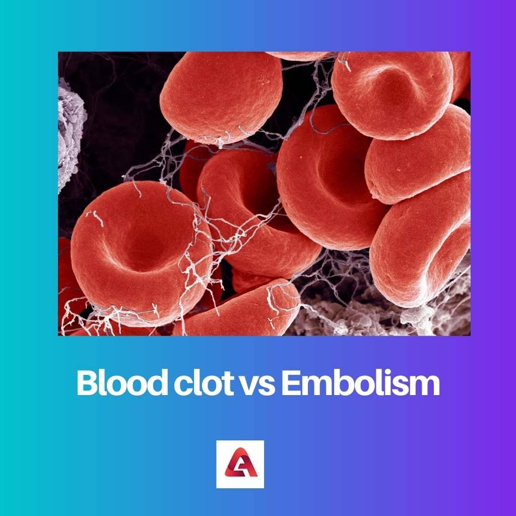 Blood clot vs Embolism