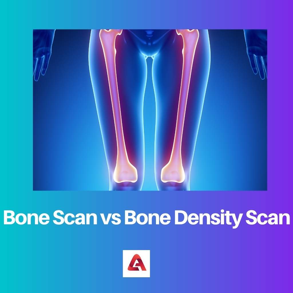 Bone Scan vs Bone Density Scan