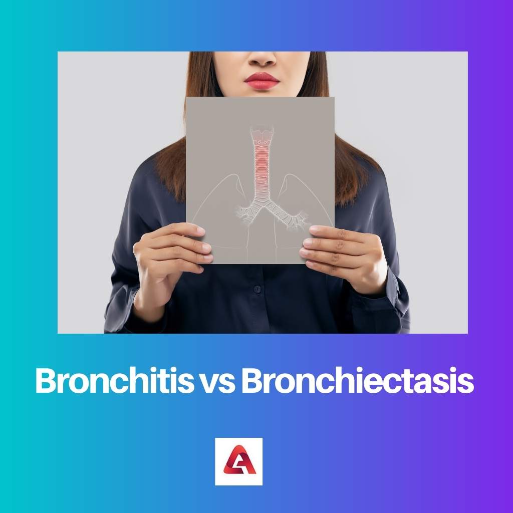 Bronchitis vs Bronchiectasis