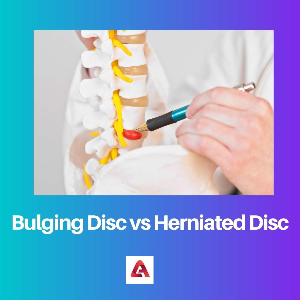 Bulging Disc vs Herniated Disc