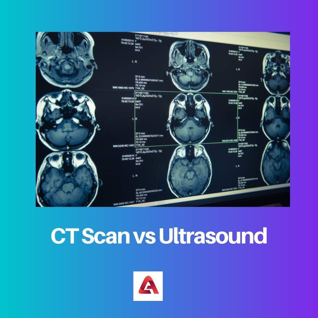 CT Scan vs Ultrasound
