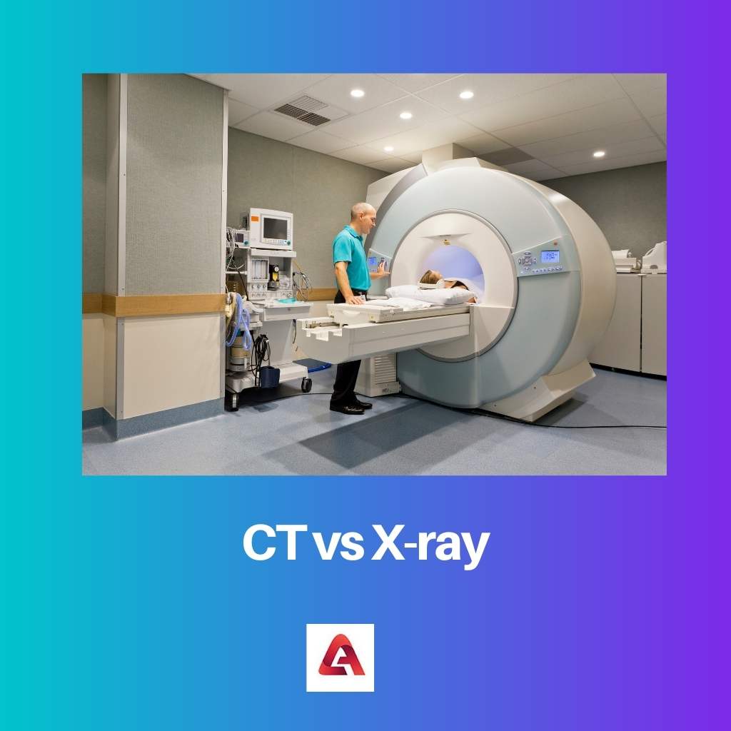 CT vs X ray
