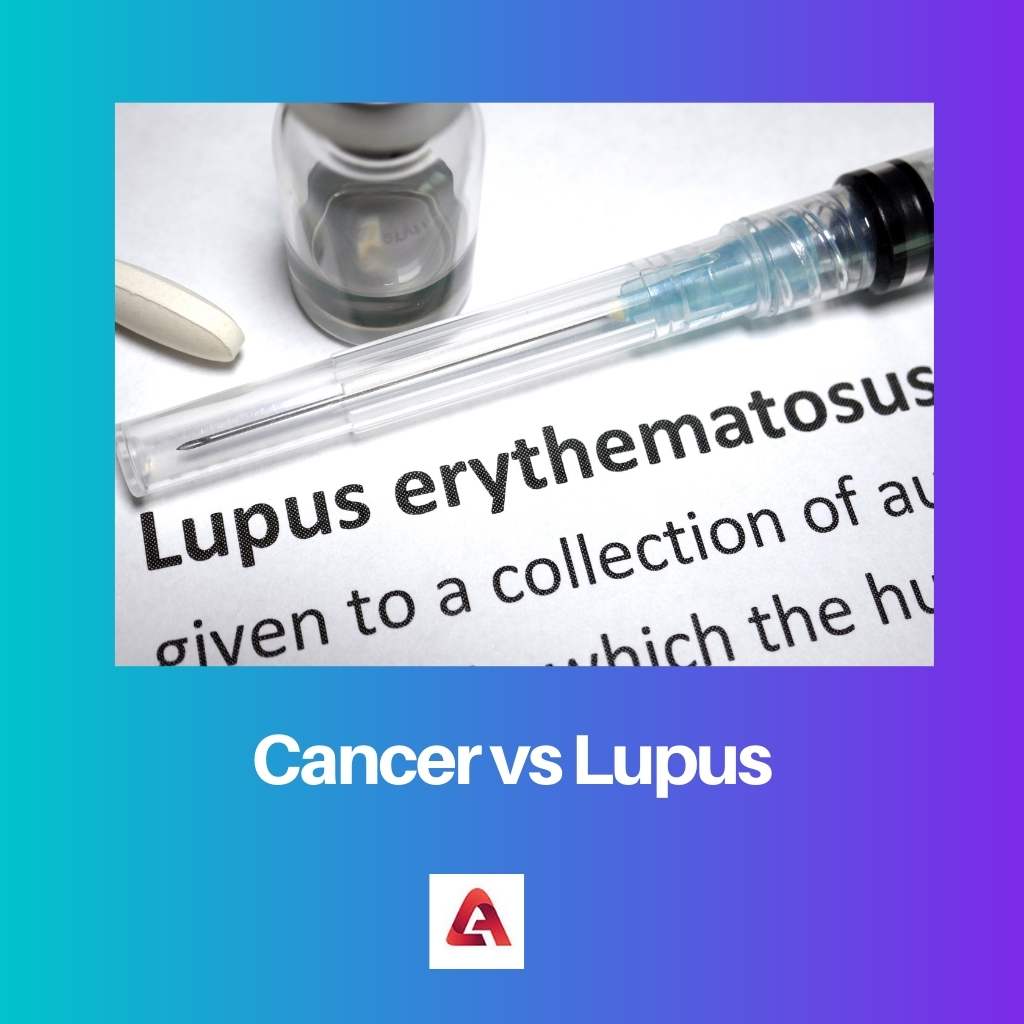 Cancer vs Lupus