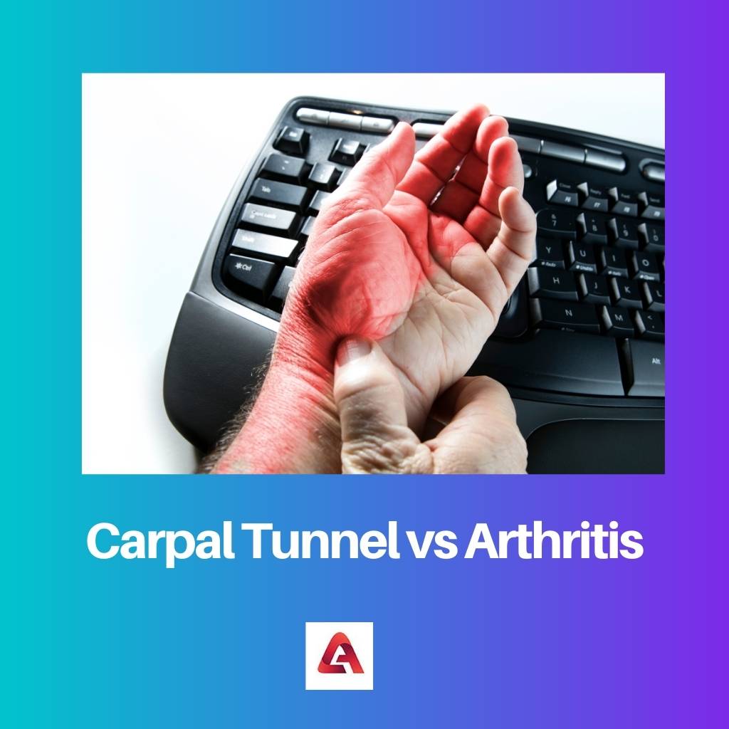 Carpal Tunnel vs Arthritis
