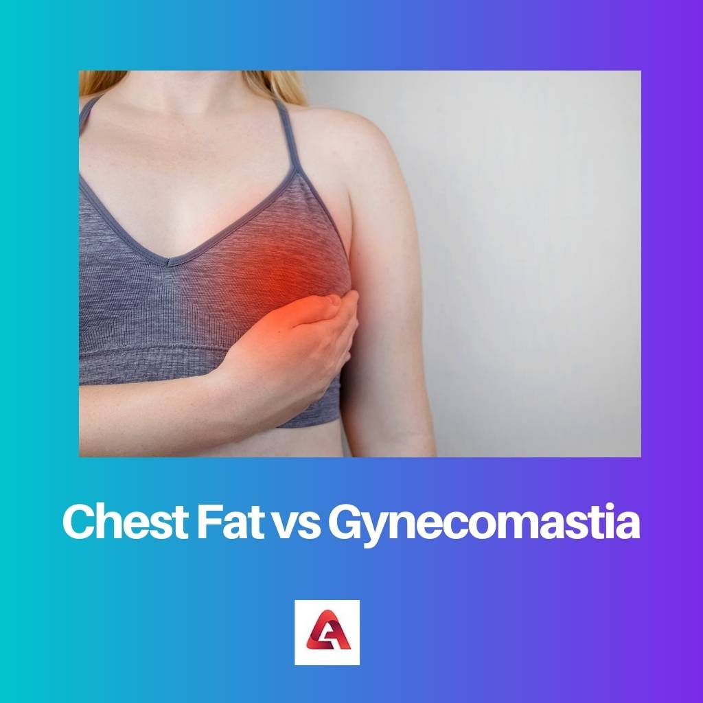Chest Fat vs Gynecomastia
