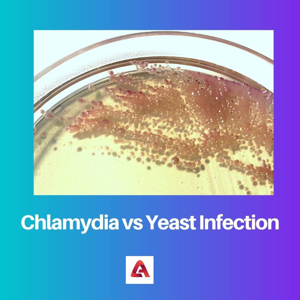 Chlamydia vs Yeast Infection