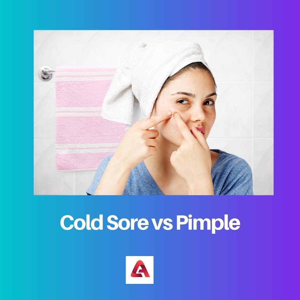 Cold Sore vs Pimple