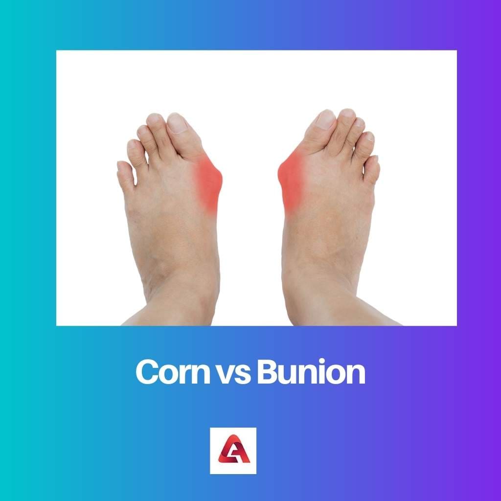 Corn vs Bunion