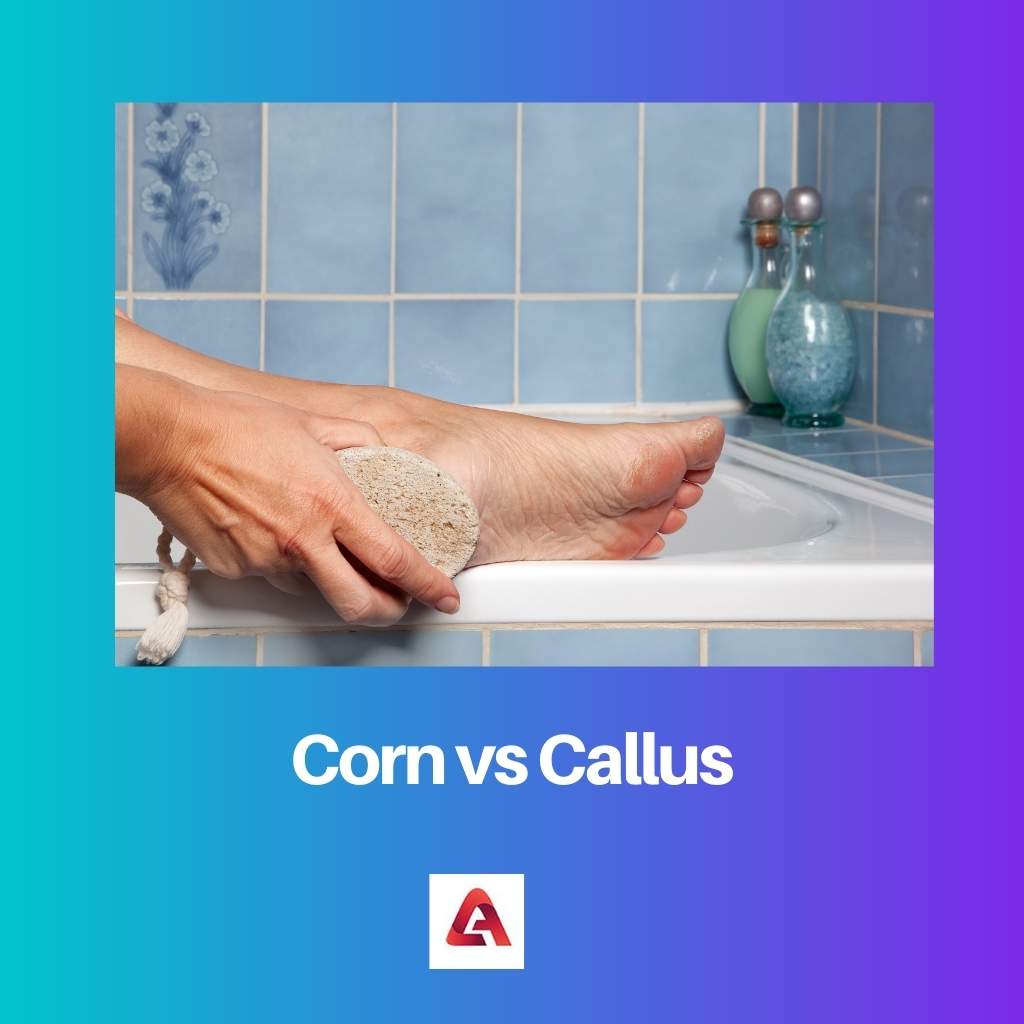 Corn vs Callus