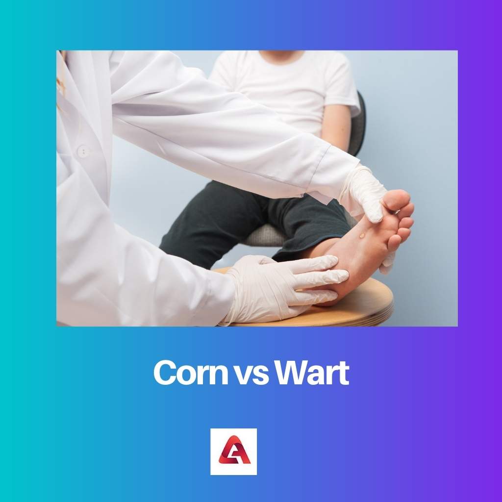 Corn vs Wart