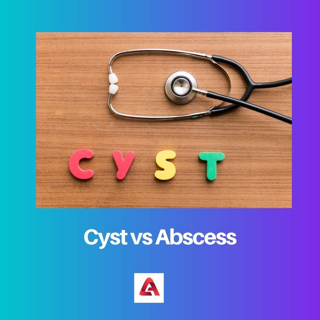 Cyst vs Abscess