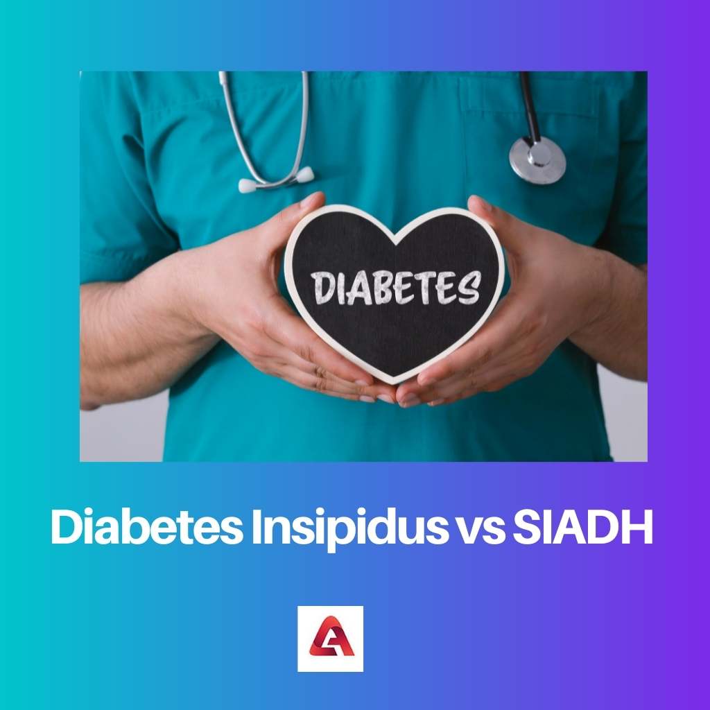 Diabetes Insipidus vs SIADH