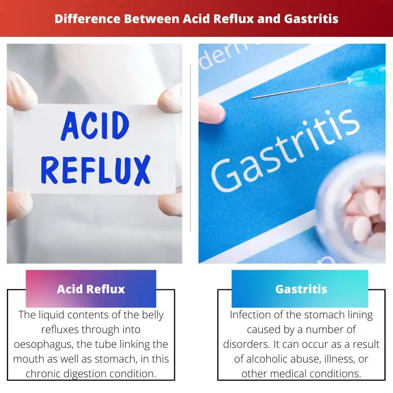 Difference Between Acid Reflux and Gastritis