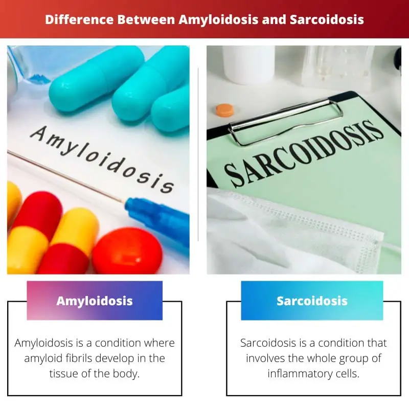 Difference Between Amyloidosis and Sarcoidosis