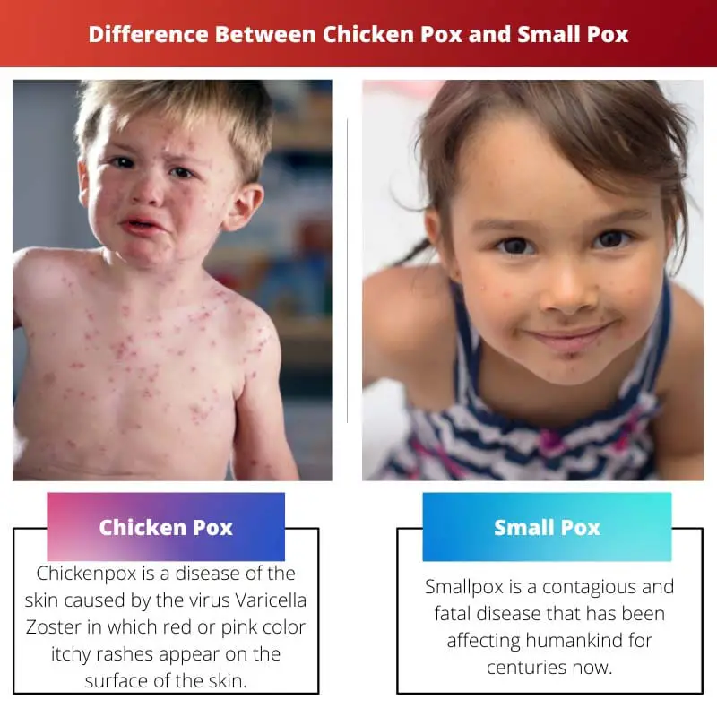 Difference Between Chicken Pox and Small