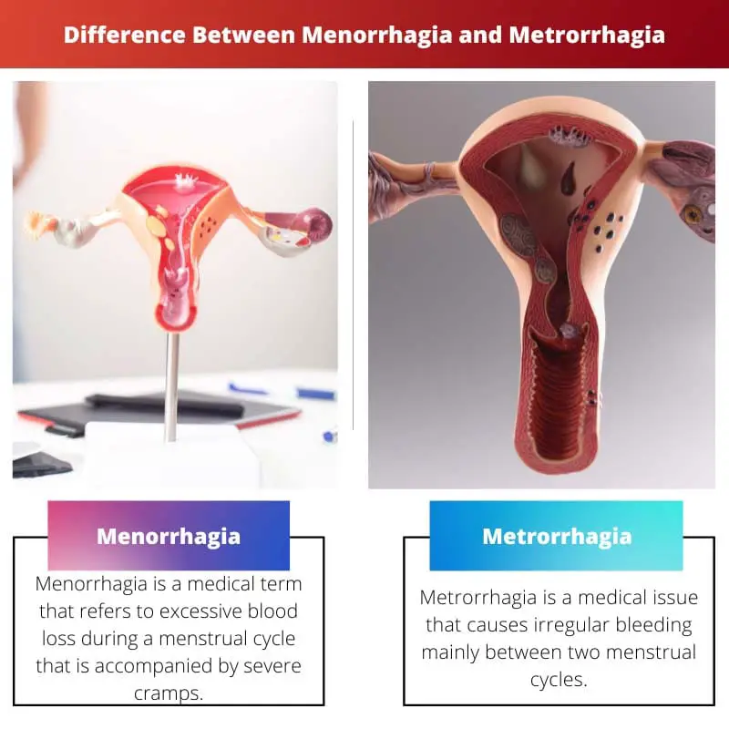 Difference Between Menorrhagia and Metrorrhagia