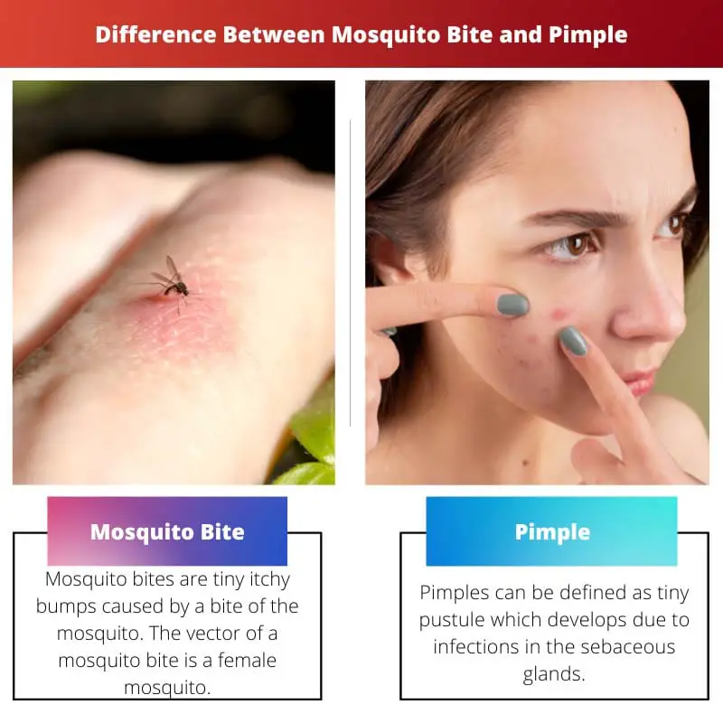 Difference Between Mosquito Bite and Pimple