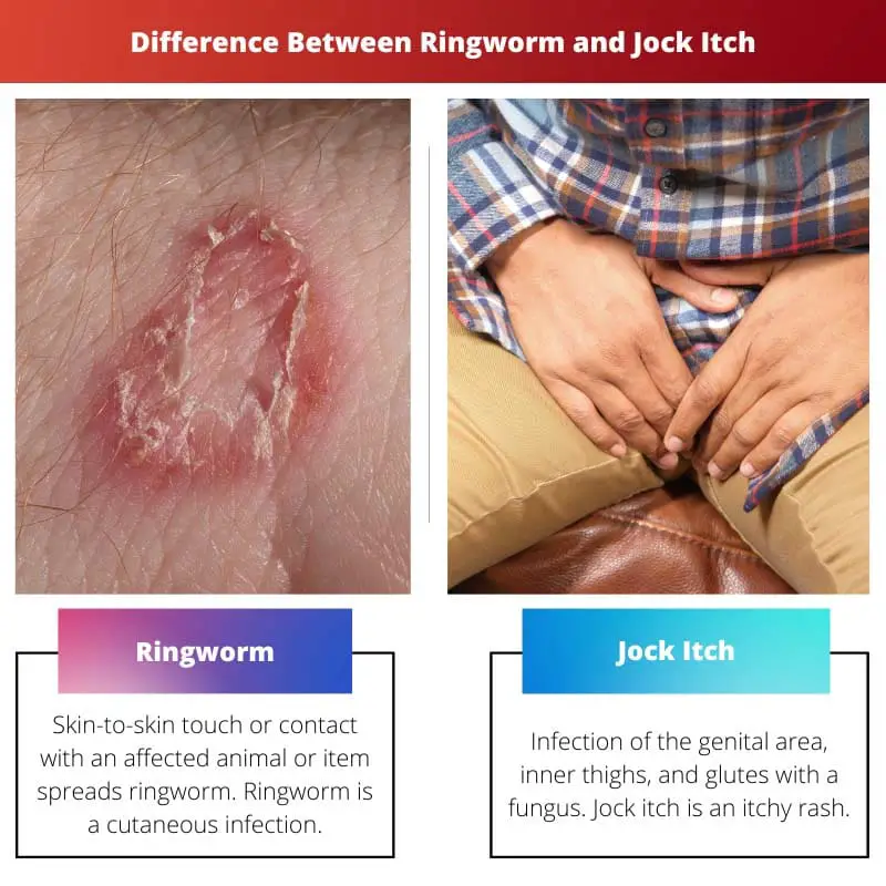 Difference Between Ringworm and Jock Itch