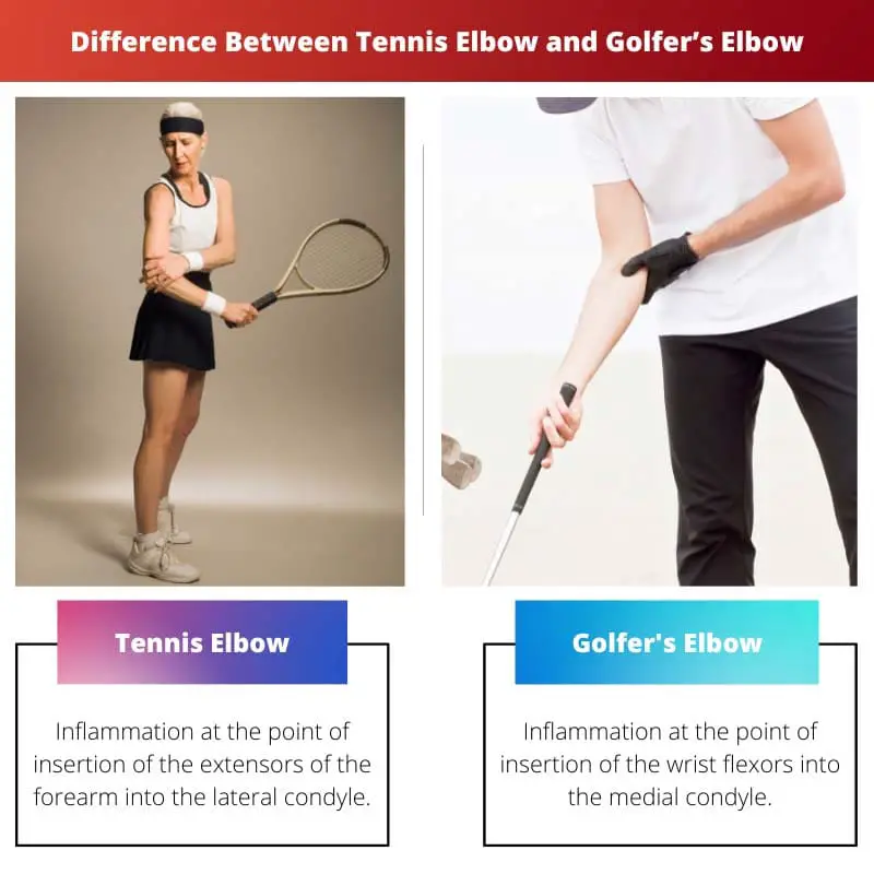 Difference Between Tennis Elbow and Golfers Elbow