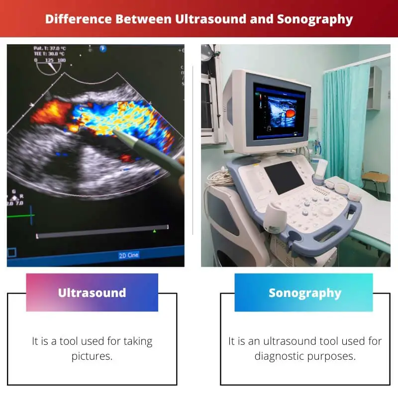 Difference Between Ultrasound and Sonography