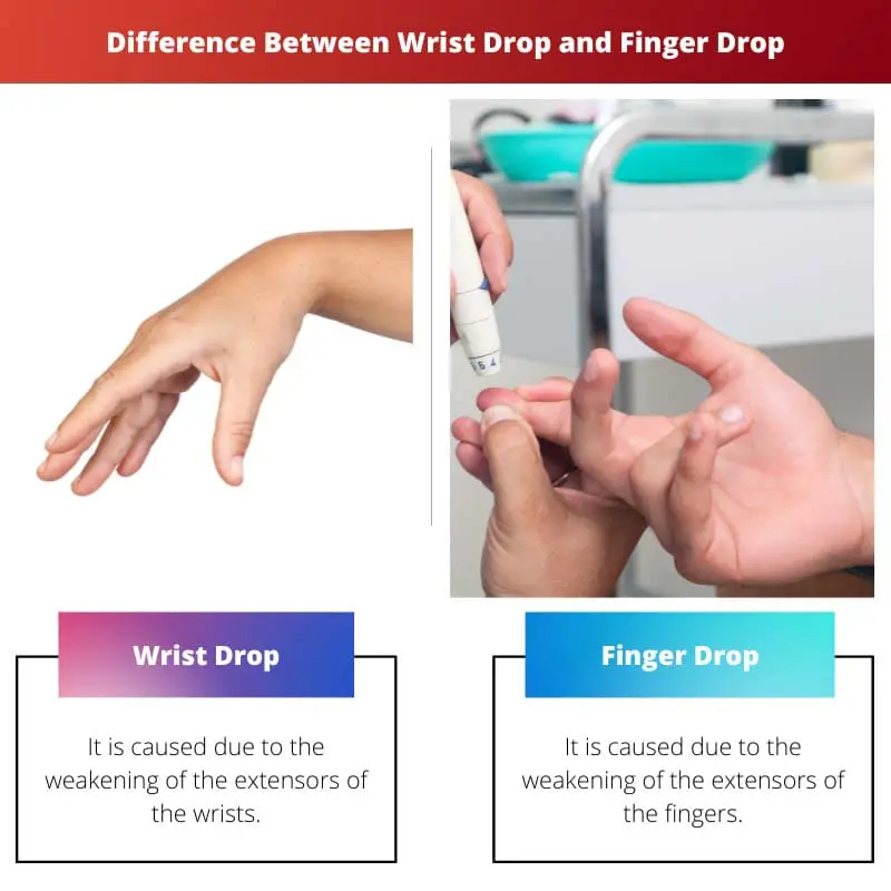 Difference Between Wrist Drop and Finger Drop