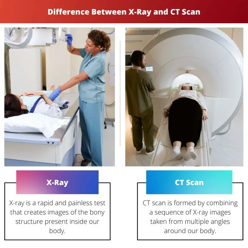 Difference Between X Ray and CT Scan