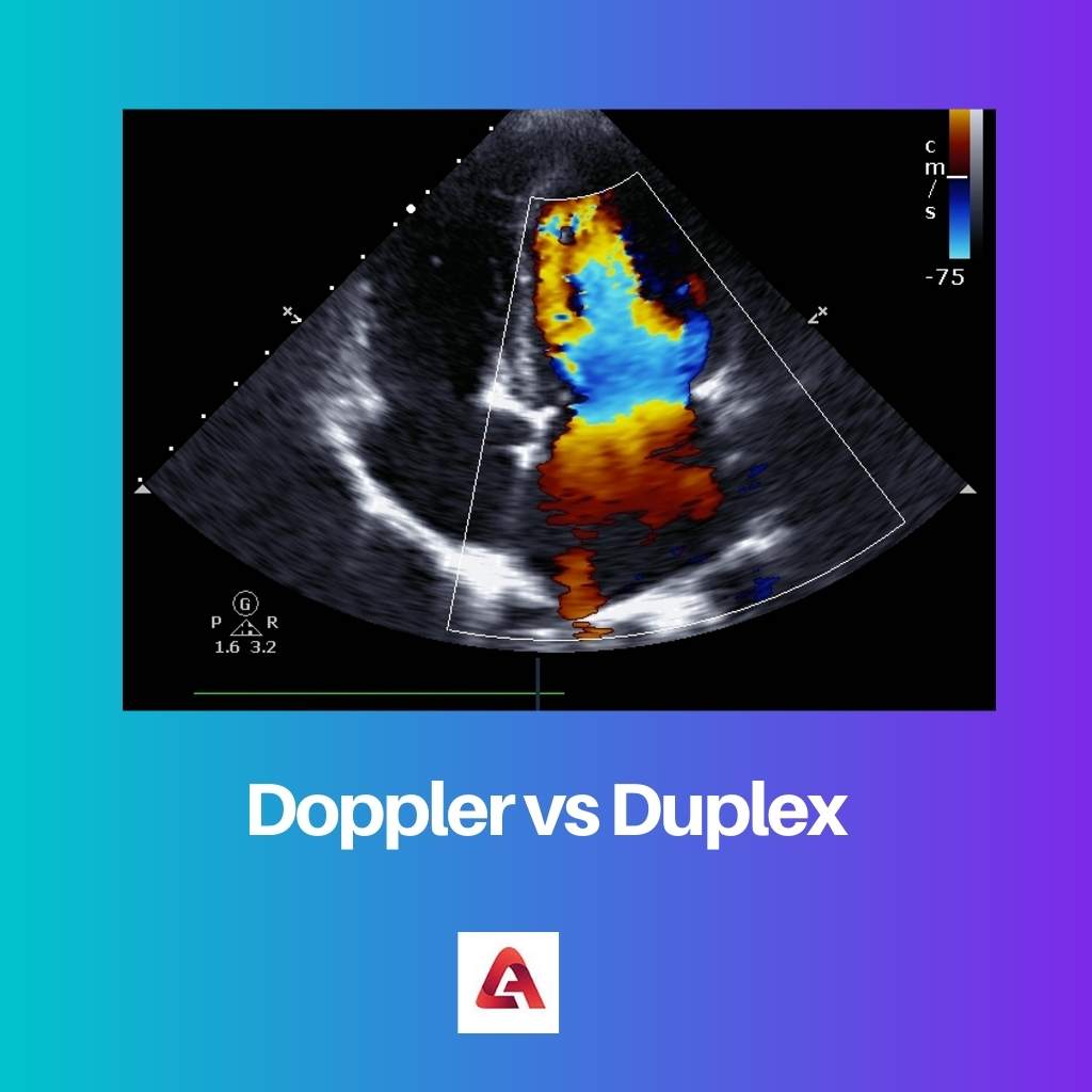 Doppler vs