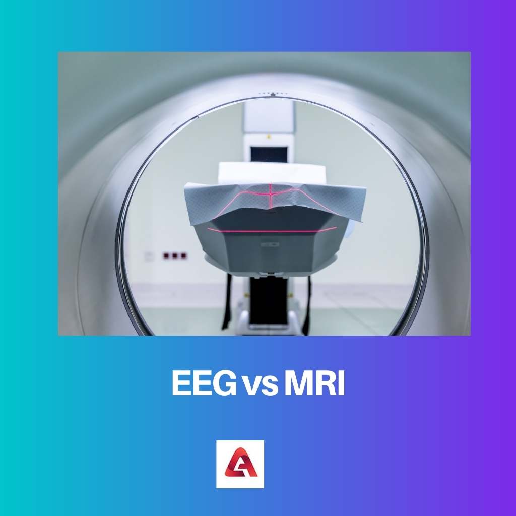 EEG vs MRI