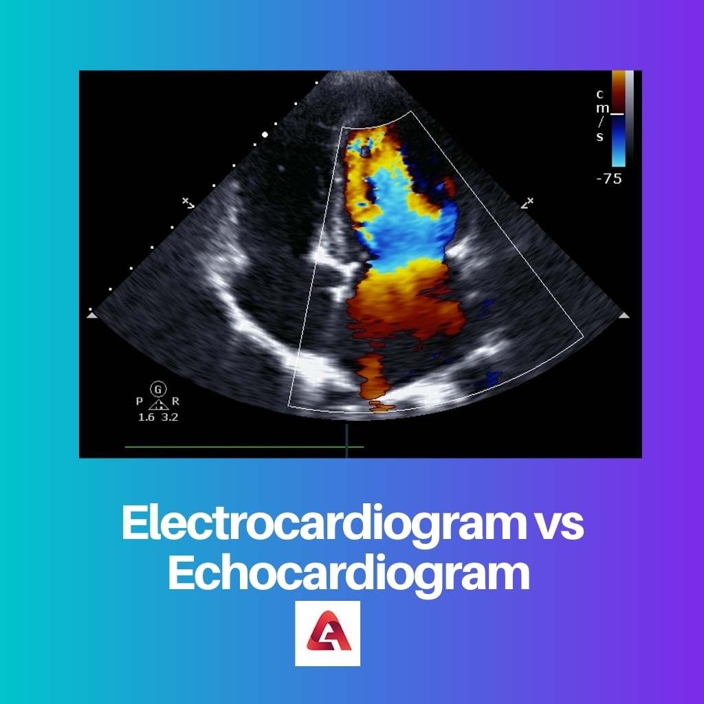 Electrocardiogram vs Echocardiogram