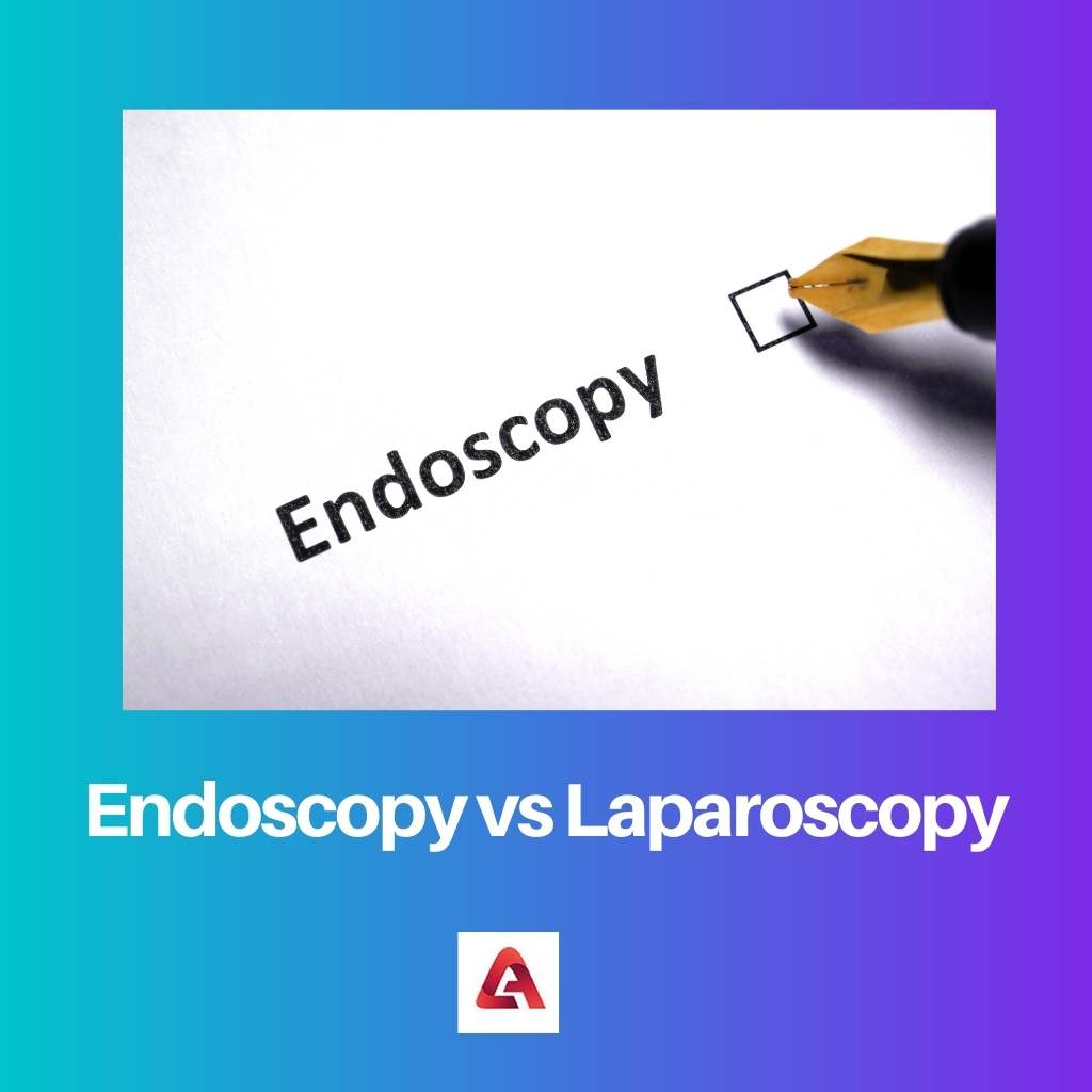 Endoscopy vs Laparoscopy 1